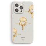 a phone case with a design of gold-colored medical illustrations of the spine.