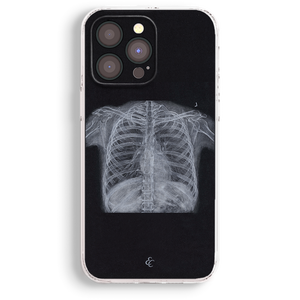 a phone case with a black background and a white x-ray image of a human ribcage.