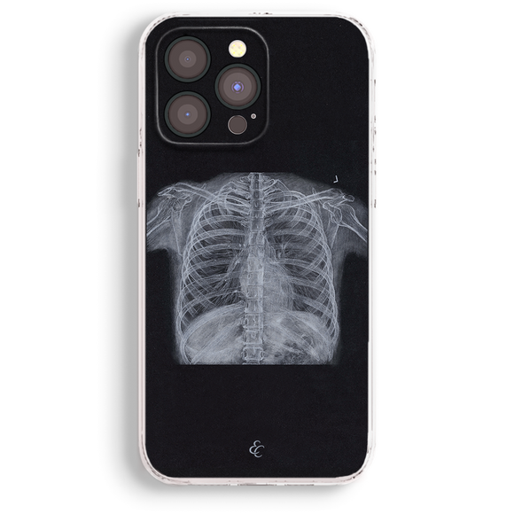 a phone case with a black background and a white x-ray image of a human ribcage.