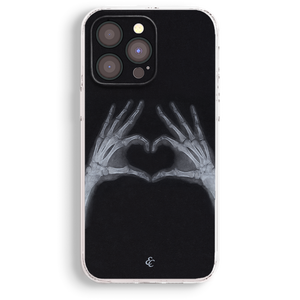 a phone case with a black background and a graphic of two skeletal hands forming a heart shape.
