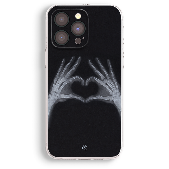 a phone case with a black background and a graphic of two skeletal hands forming a heart shape.