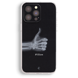 a phone case with a black background and a white x-ray image of a hand giving a thumbs up. The name "William" is written below the x-ray image.