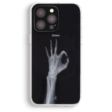 a black and white x-ray of a skeletal hand with the name 'James' written above it.