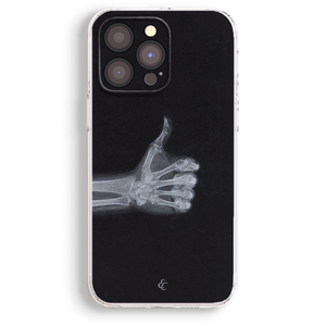 a phone case with a black background and a white skeleton hand giving a thumbs up gesture.