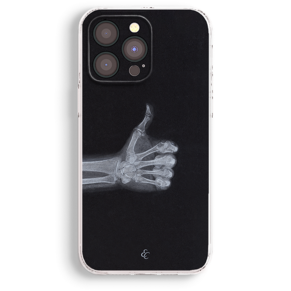 a phone case with a black background and a white skeleton hand giving a thumbs up gesture.