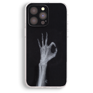 a skeleton hand making an "okay" gesture, with the bones clearly visible against a dark background.