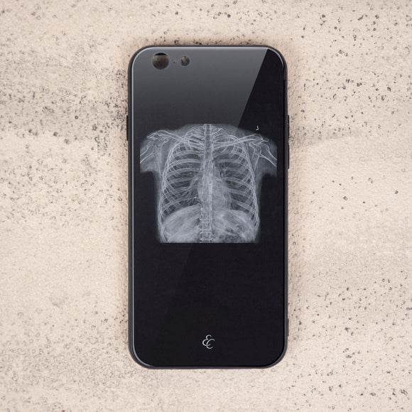 胸部X光玻璃手機殼