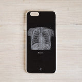 胸部X光手機殼
